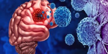 استفاده از این کلاه می‌تواند روشی برای درمان سرطان مغز باشد