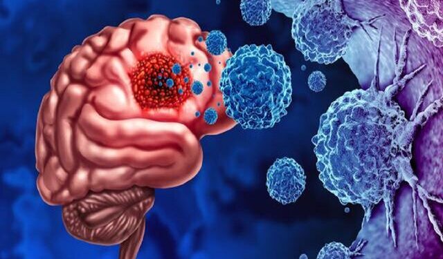 استفاده از این کلاه می‌تواند روشی برای درمان سرطان مغز باشد