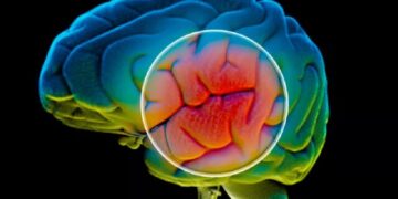 هوش مصنوعی می‌تواند در تشخیص پارکینسون مورد استفاده قرار بگیرد