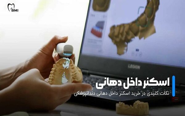 دستگاه میلینگ دندانسازی و اسکنر داخل دهانی در دندانپزشکی