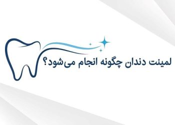 لمینت دندان چگونه انجام می‌شود و مناسب چه کسانی است؟