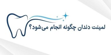 لمینت دندان چگونه انجام می‌شود و مناسب چه کسانی است؟