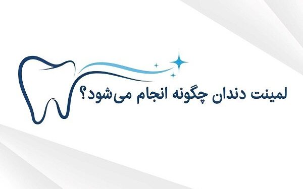 لمینت دندان چگونه انجام می‌شود و مناسب چه کسانی است؟